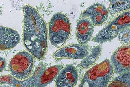 How can Toxoplasma gondii infect people? These are the easiest ways